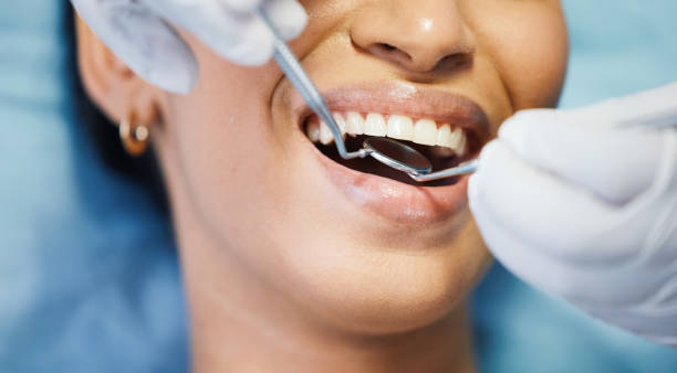 Best Emergency Treatment for Dental Infections or Abscesses in Rodeo, CA